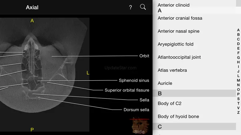 CBCT 1.40