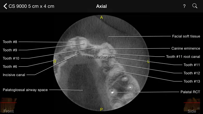 CBCT 1.40