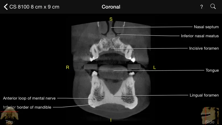 CBCT 1.40