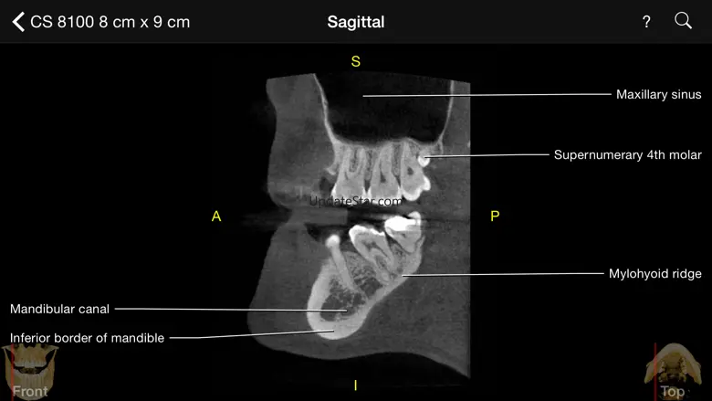 CBCT 1.40