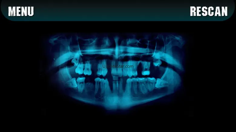 Simulator X-ray Teeth Prank 1.2