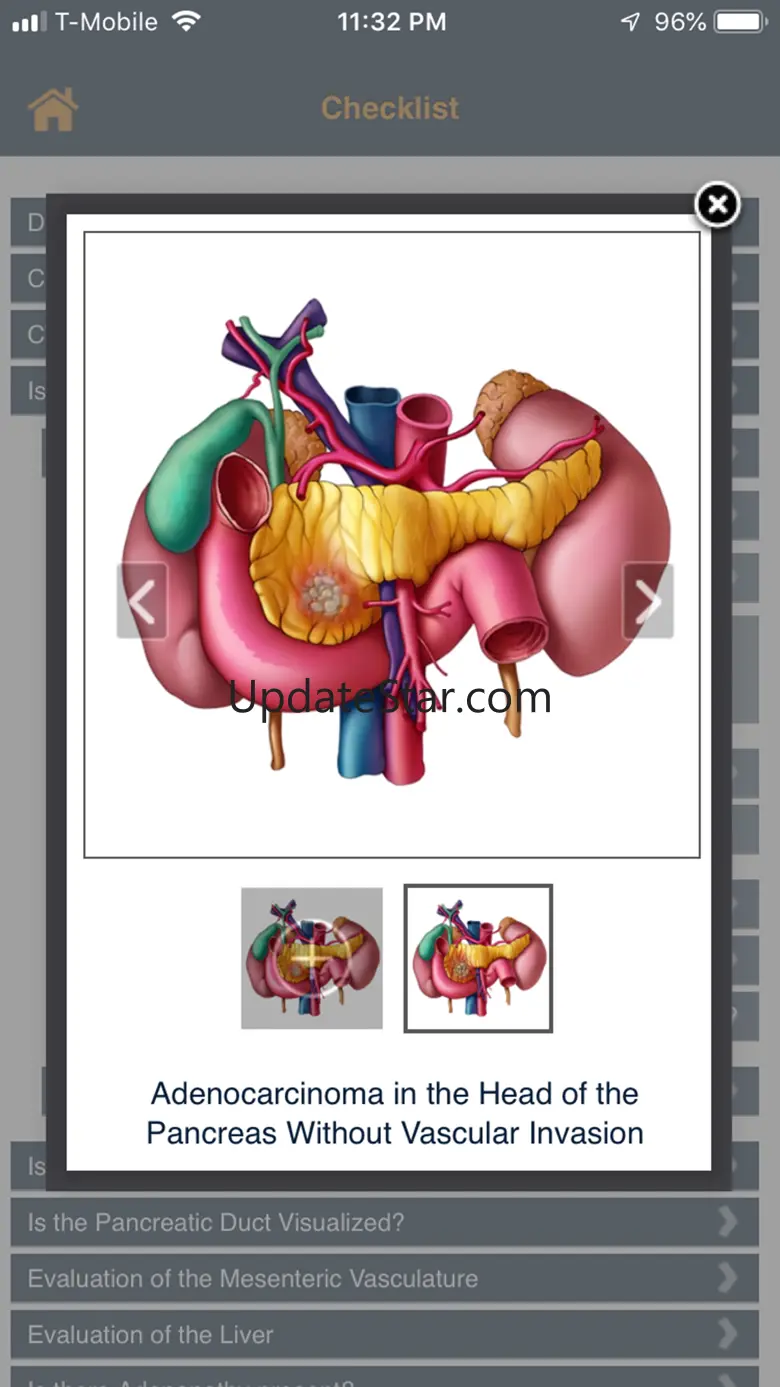 CTisus Pancreas Mass Checklist 2.0