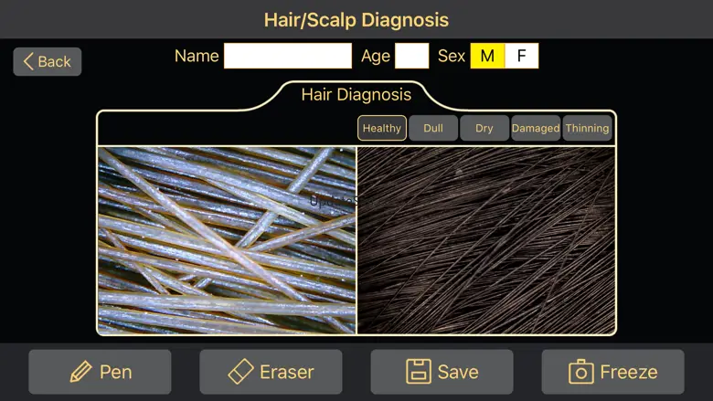Diagnosis 5.0.0.6