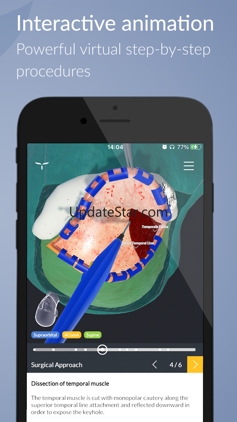UpSurgeOn Neurosurgery 2.99