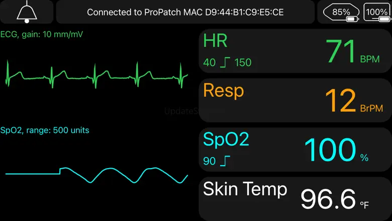 ProPatch Connect 2.14