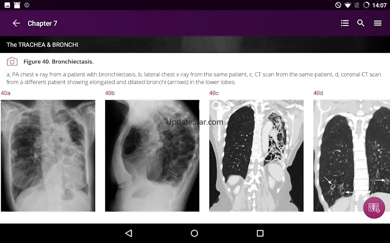 Chest X-Ray DEMO 1.3.1