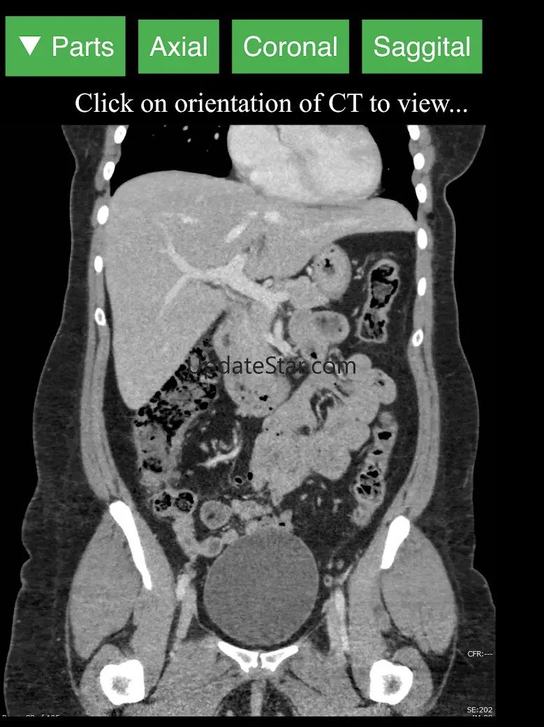 Radiology CT Viewer 1.2