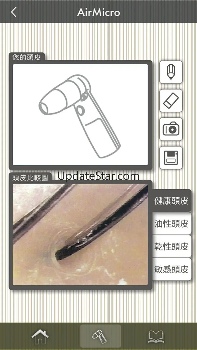 myscalp 1.2