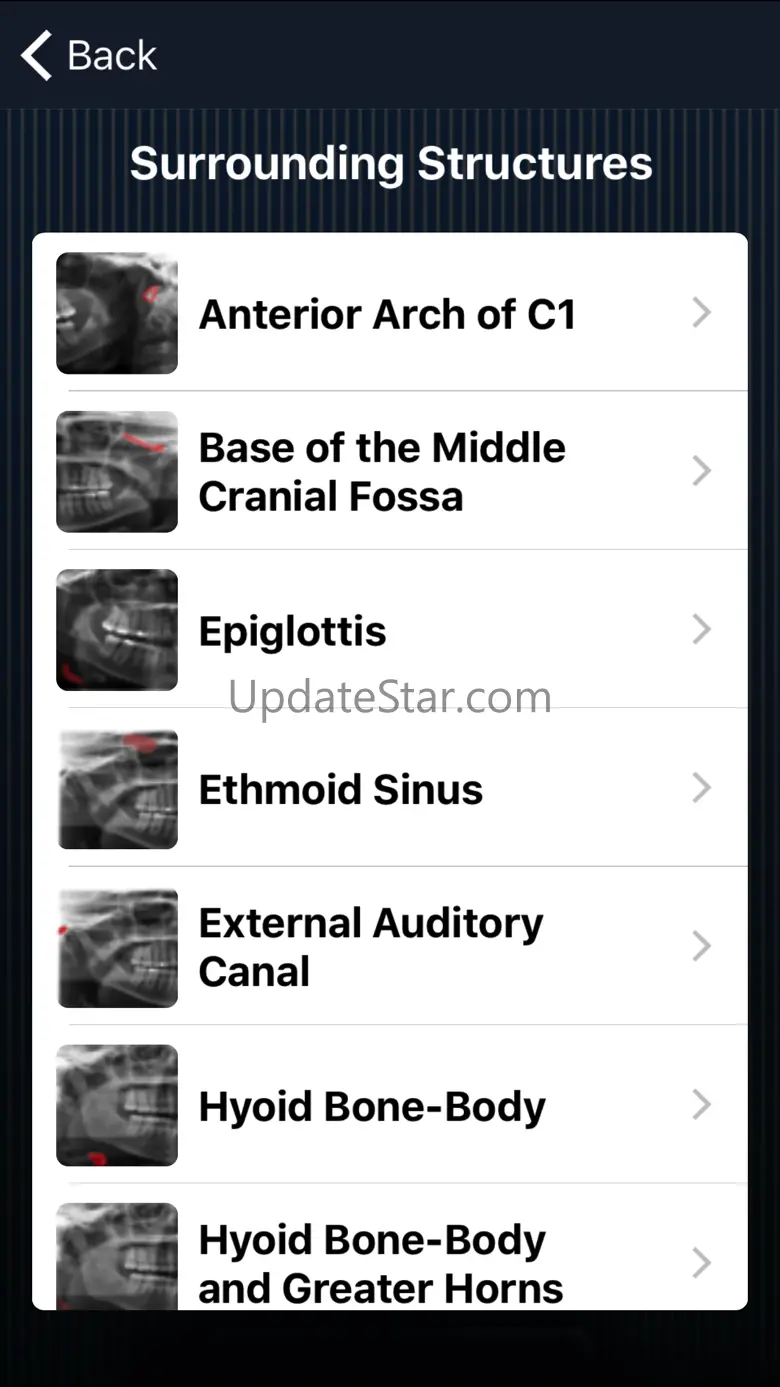 Dental Panoramic Radiology 1.1