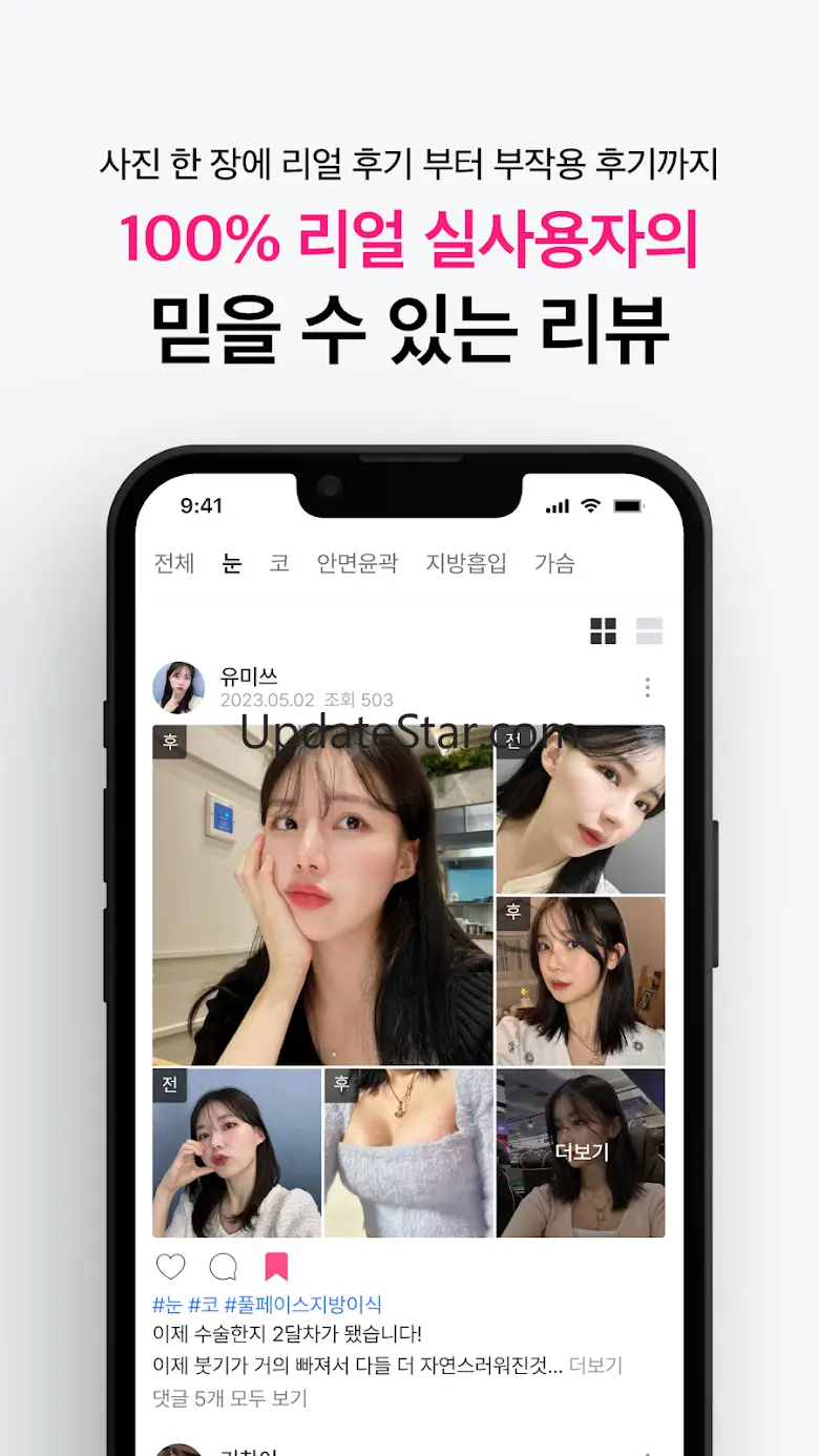 쀼 - 성형, 피부 숏폼 영상 후기 앱 1.0.01