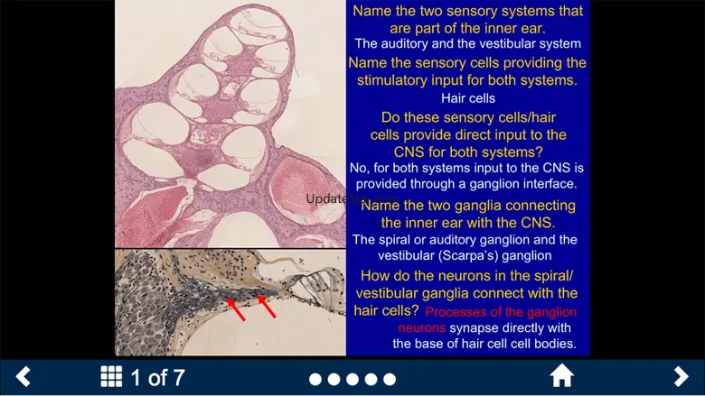 Neuroanatomy - SecondLook 3.1