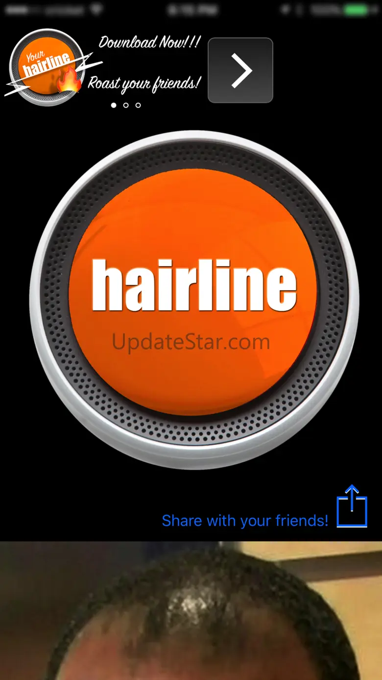 Hairline 1.1