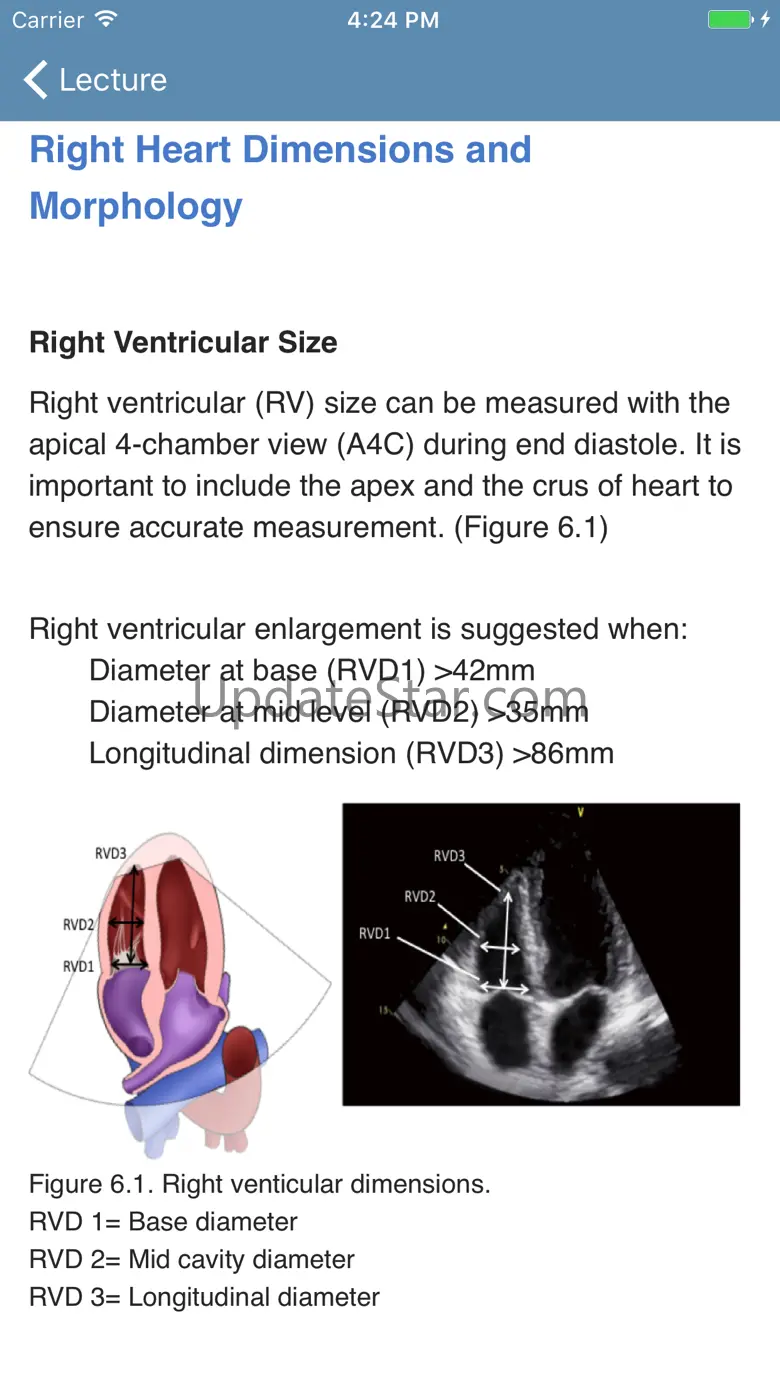 BASIC - Transthoracic Echocard 1.50