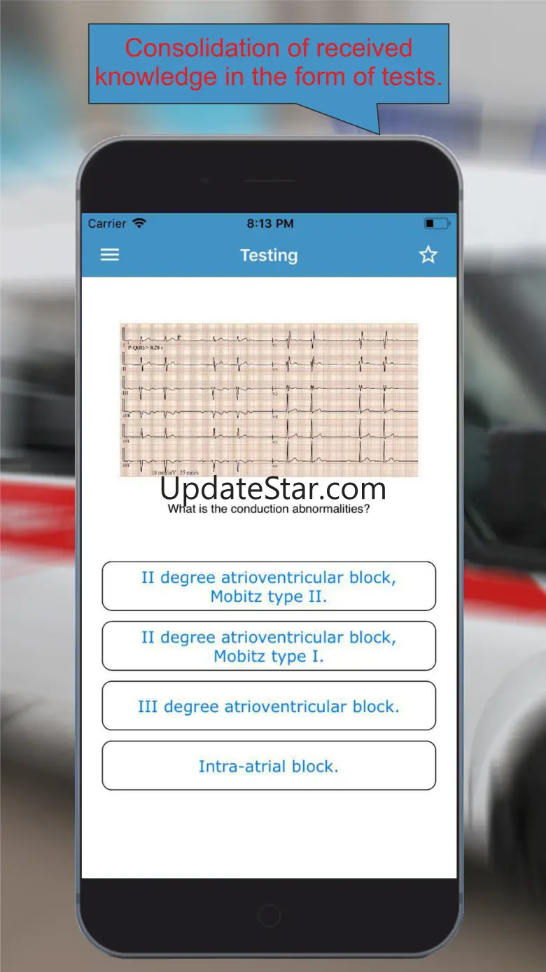 ECG: Interpritation and Tests. 1.0