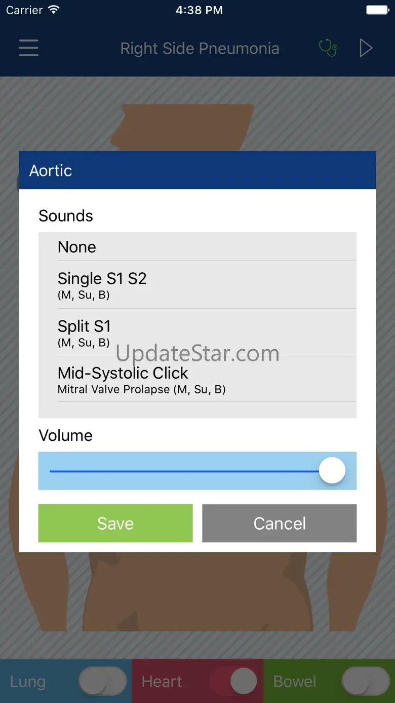 AURiS 1.0.1