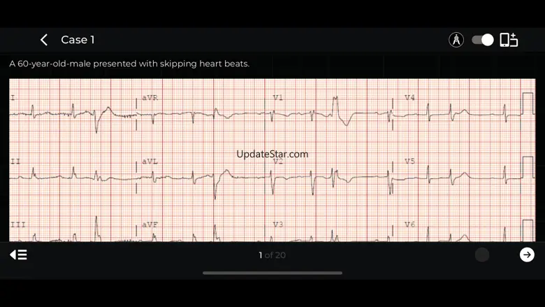 ECG Corner 1.0.5