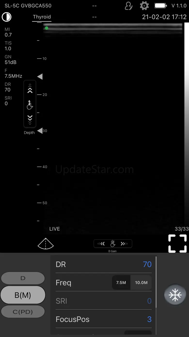 microVUE 1.3.31