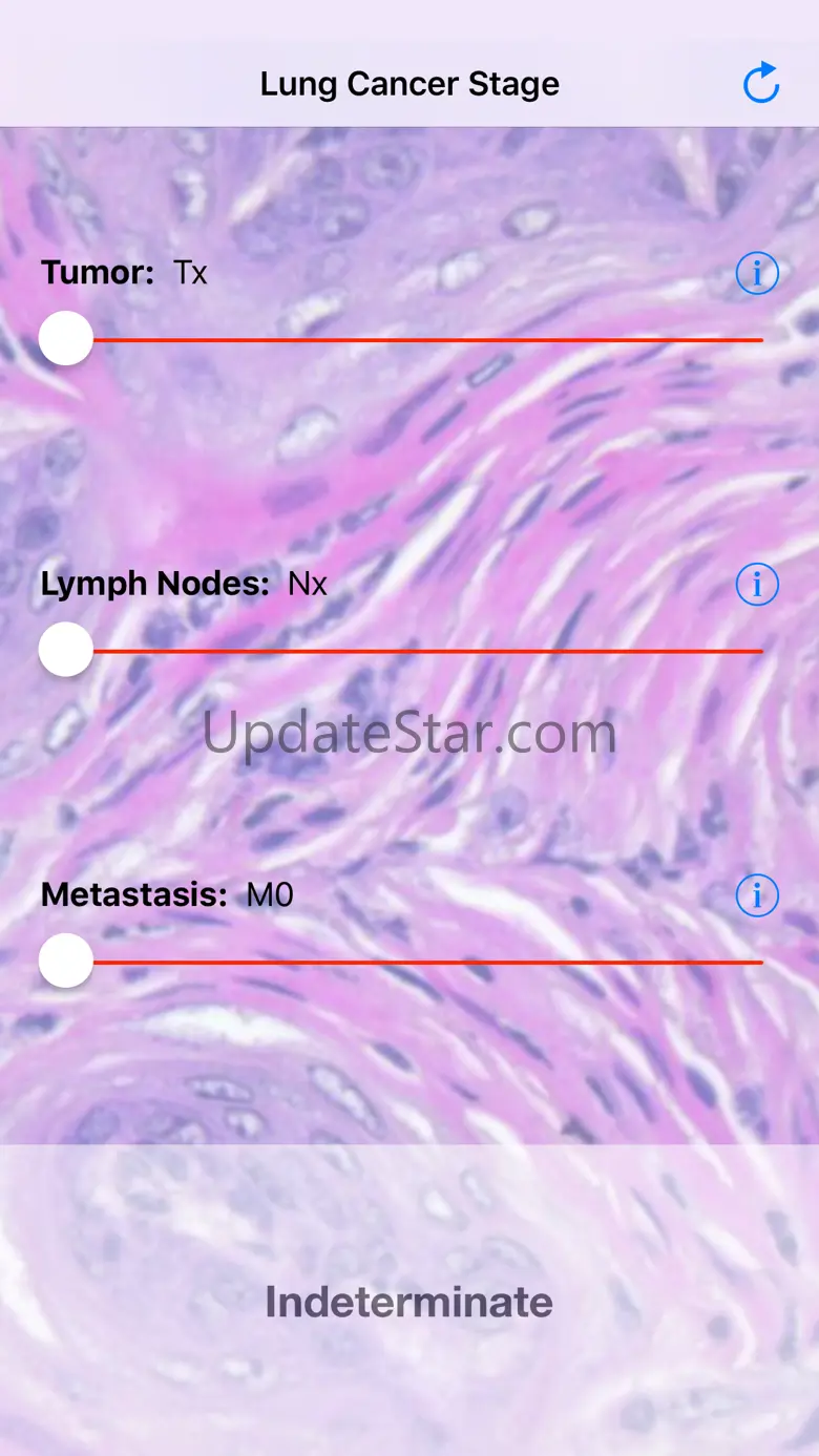 Lung Cancer Stage 1.2