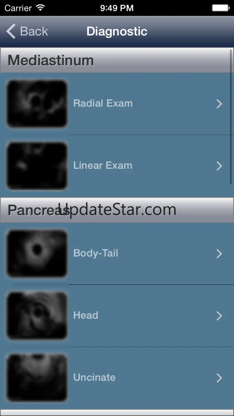 EUS - Diagnostic and Interventional Endoscopic Ultrasound 3.9.4