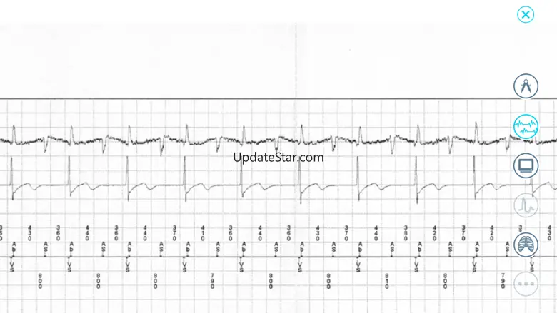 Cardiac Device Challenge 2.0