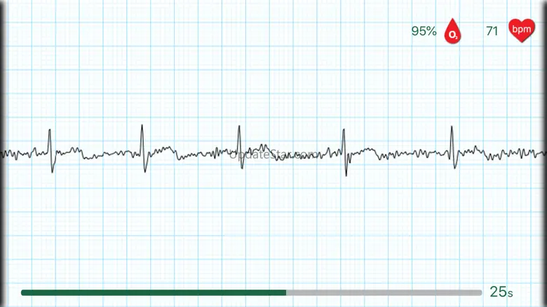 WIWE - ECG diagnostics 2.3.3