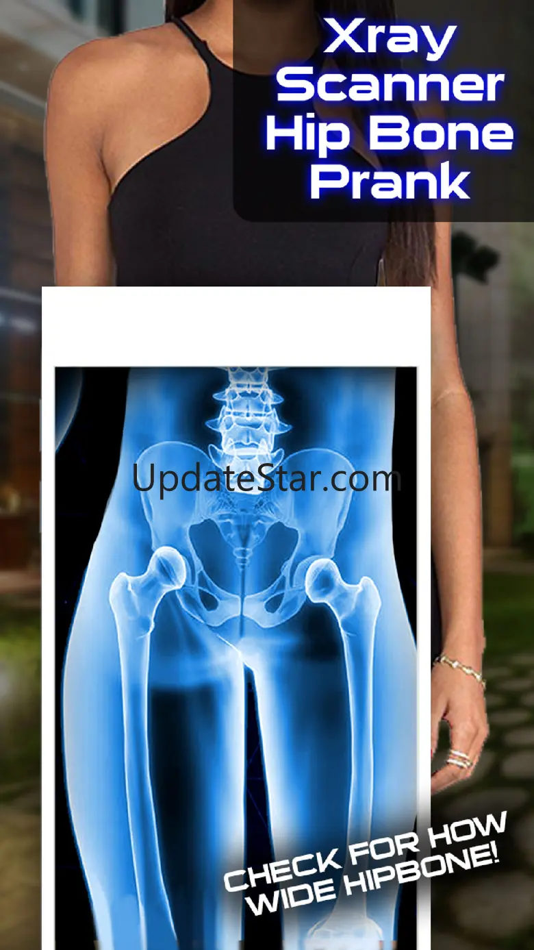 Xray Scanner Hip Bone Prank 1.0