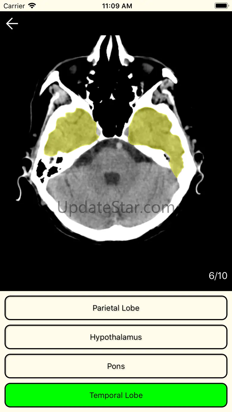 RadAnatomy 1.7