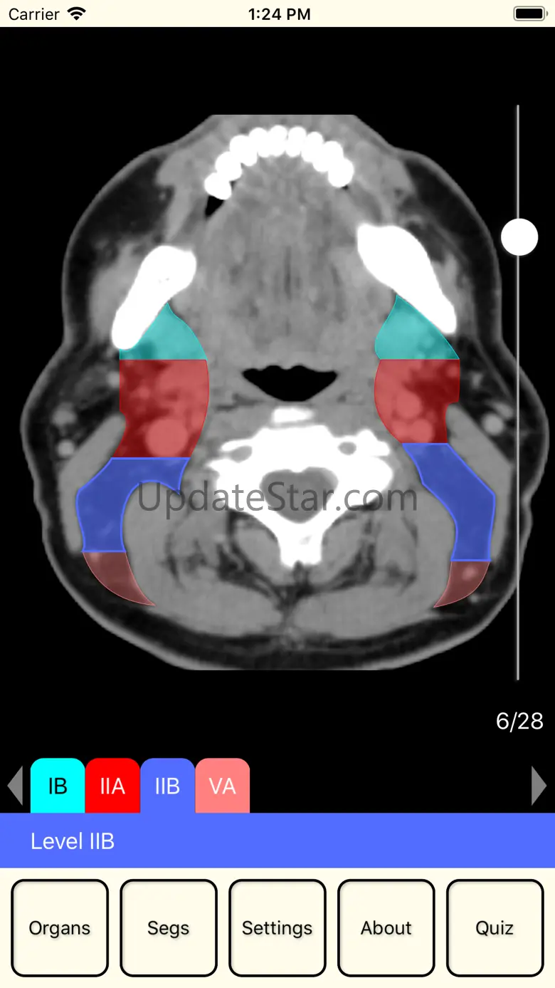 RadAnatomy 1.7
