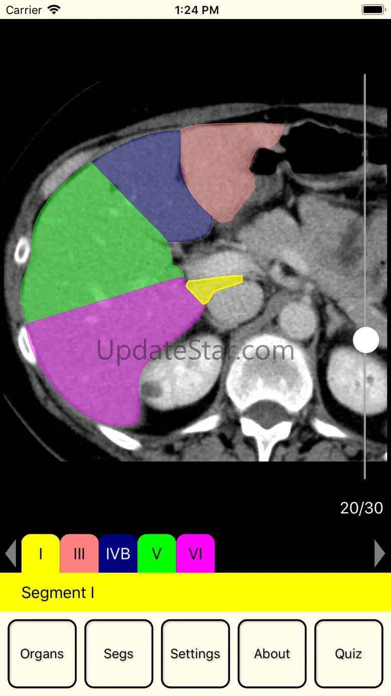 RadAnatomy 1.7