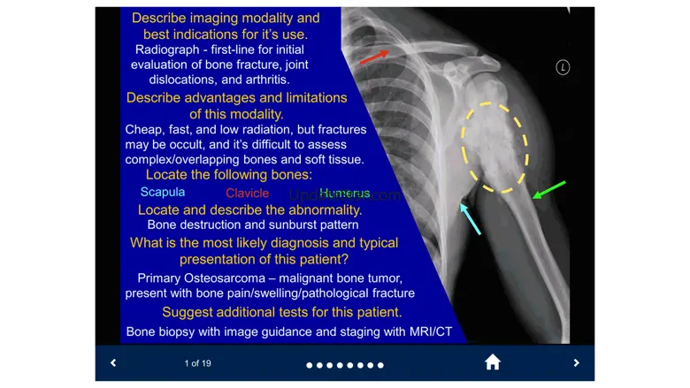 Basic Radiology - SecondLook 1.0.1