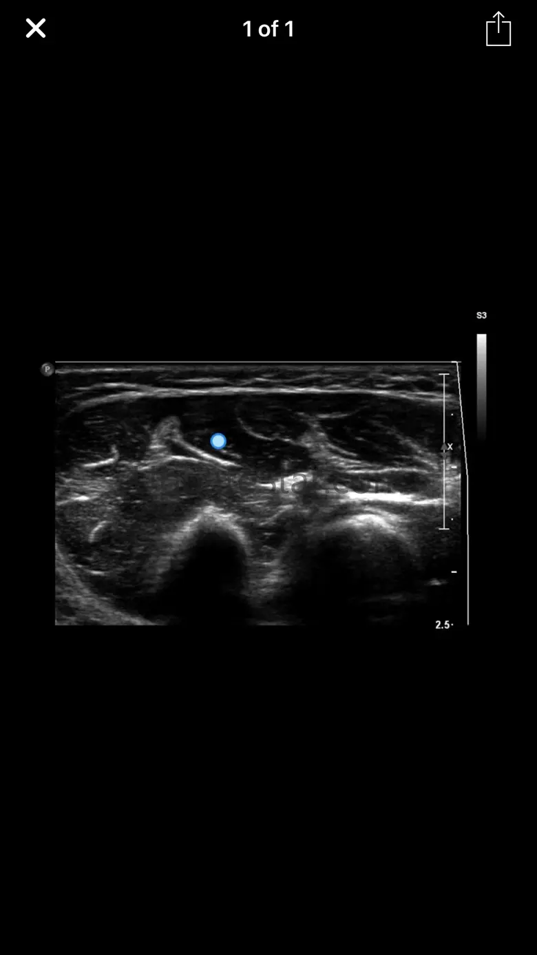 Muscle Ultrasound Course 1.0.3