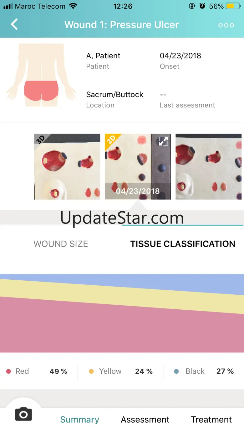 eKare inSight Europe 2.2.1