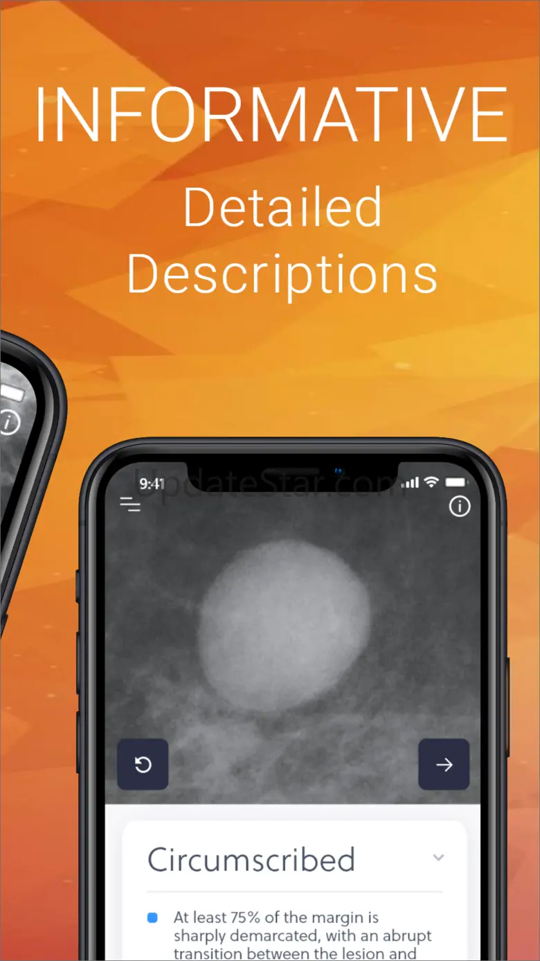 Mammography Assistant 1.4.0