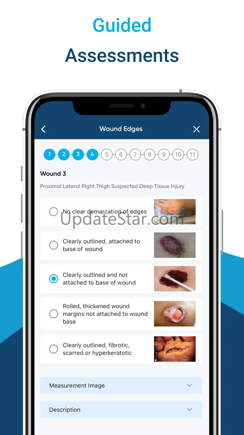 InteliWound 3.23.3