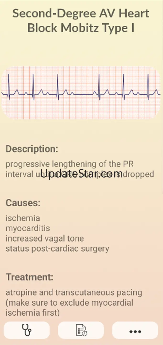 ECG Guide 6.1