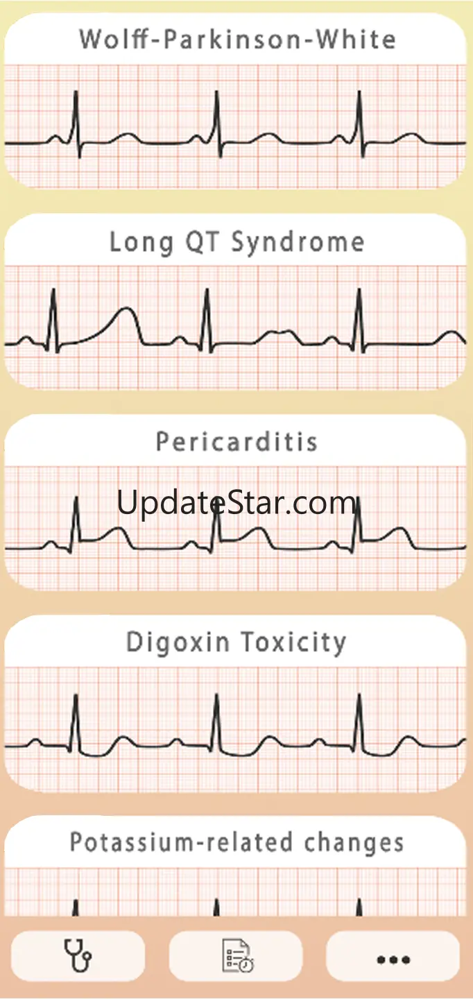 ECG Guide 6.1