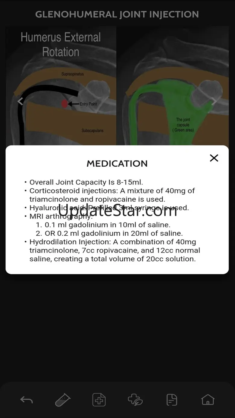 VBS RadGuide: MSK Injections 1.0.2