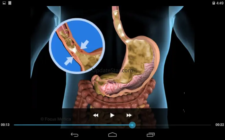Animated Medical Dictionary v1.6.2