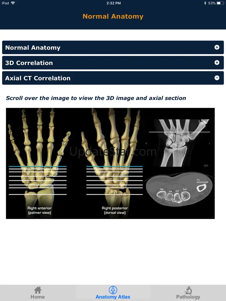 CTisus: CT of the Hand & Wrist 3.0