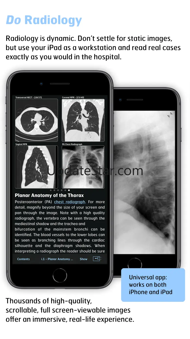 Radiology - Thoracic Imaging 1.8