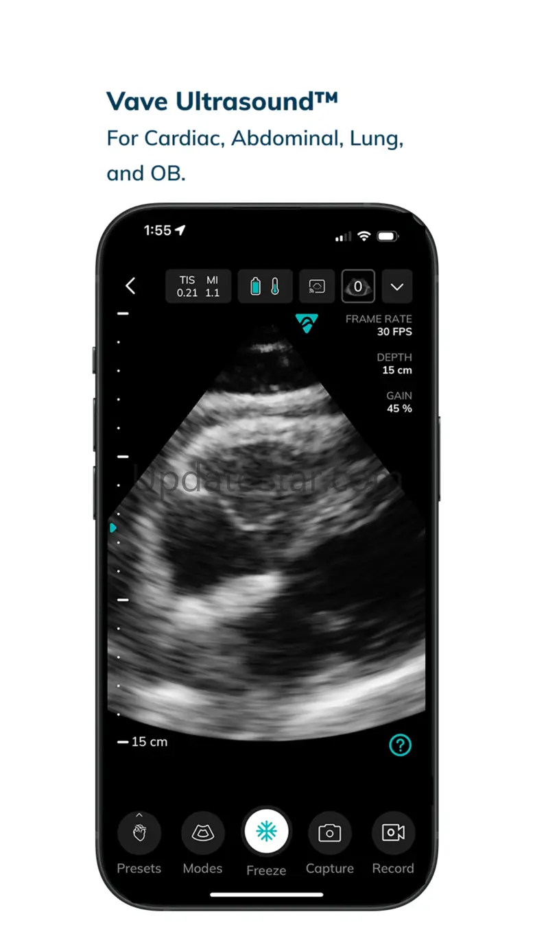 Vave Health 4.2.11