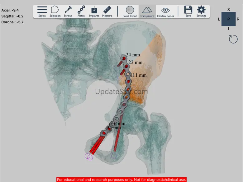 Ossa 3D 1.0.0