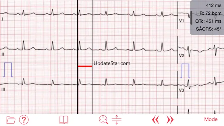 Photo EKG 1.0.1