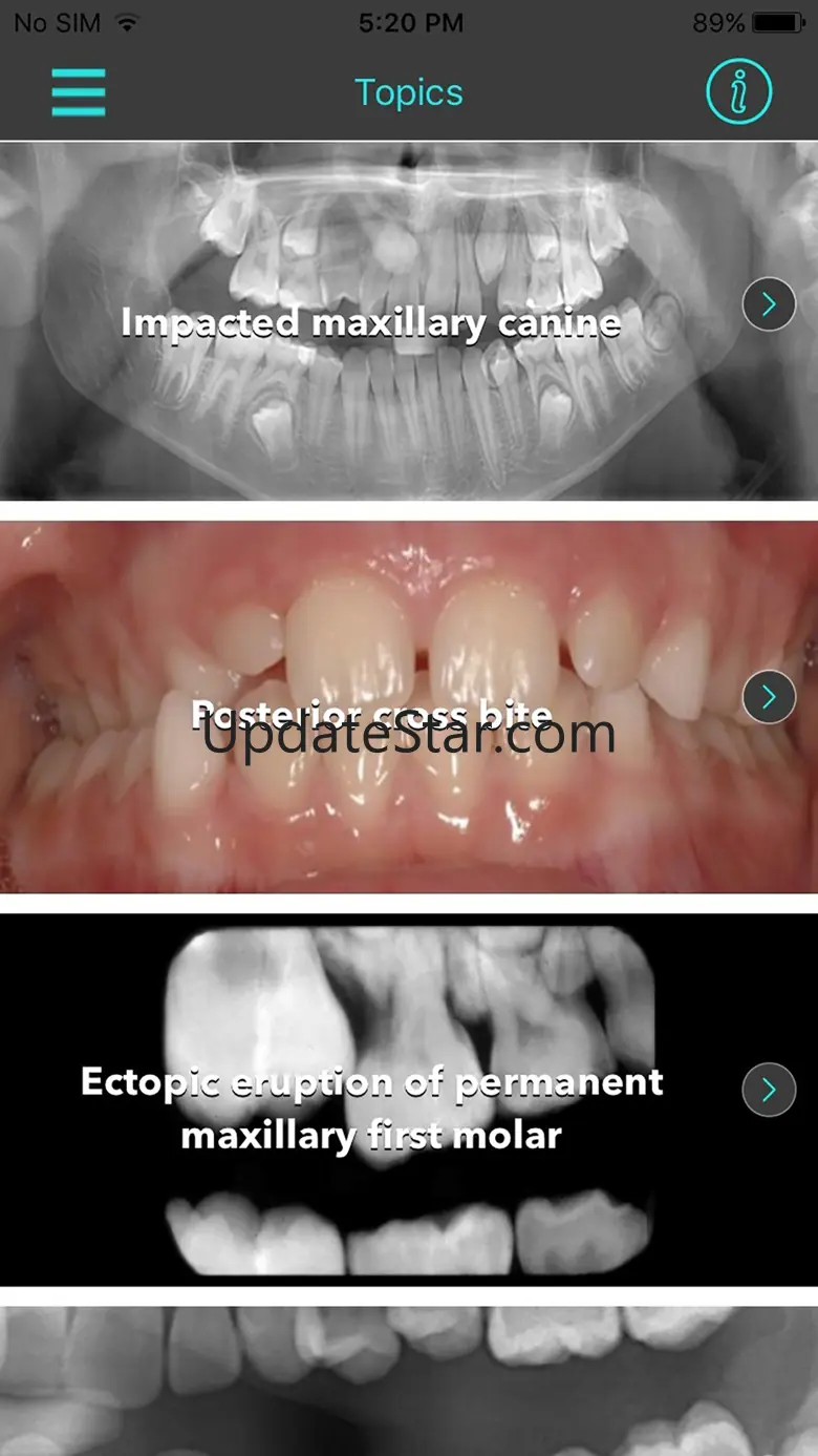 Interceptive Orthodontics 1.5.1