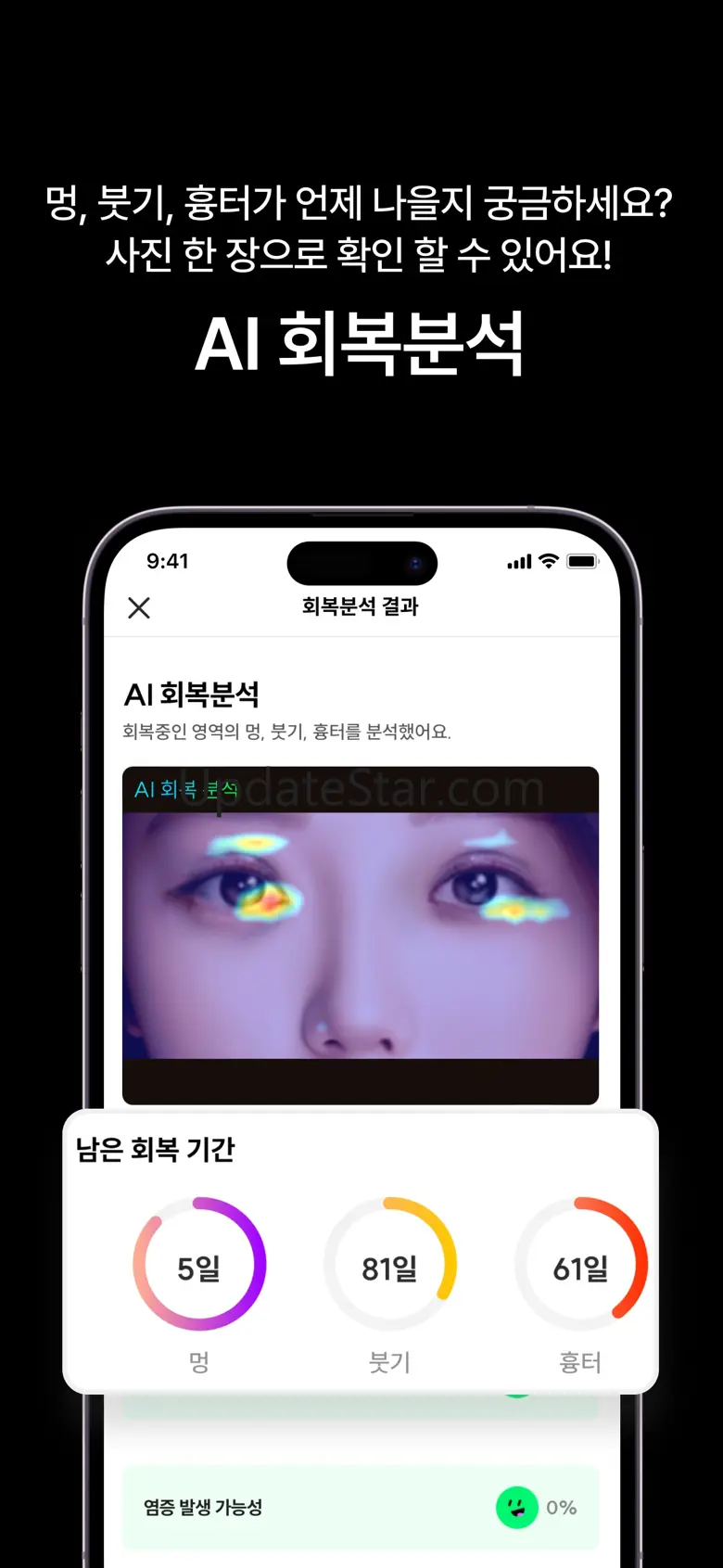 페이스핏 - 성형,견적,상담,분석,시술,얼굴,시뮬레이션 4.10.3