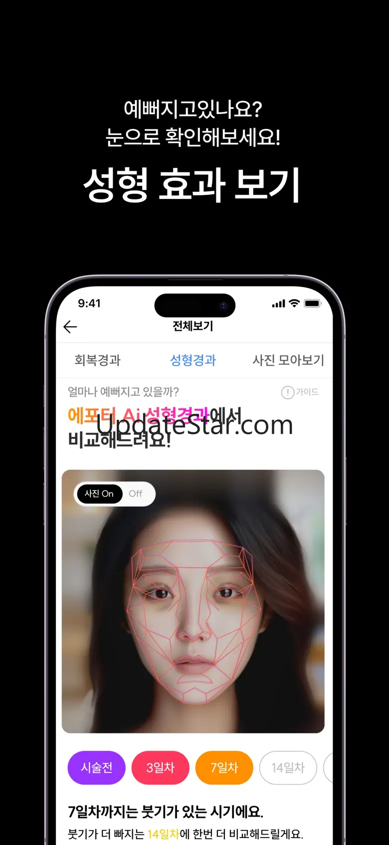 페이스핏 - 성형,견적,상담,분석,시술,얼굴,시뮬레이션 4.10.3