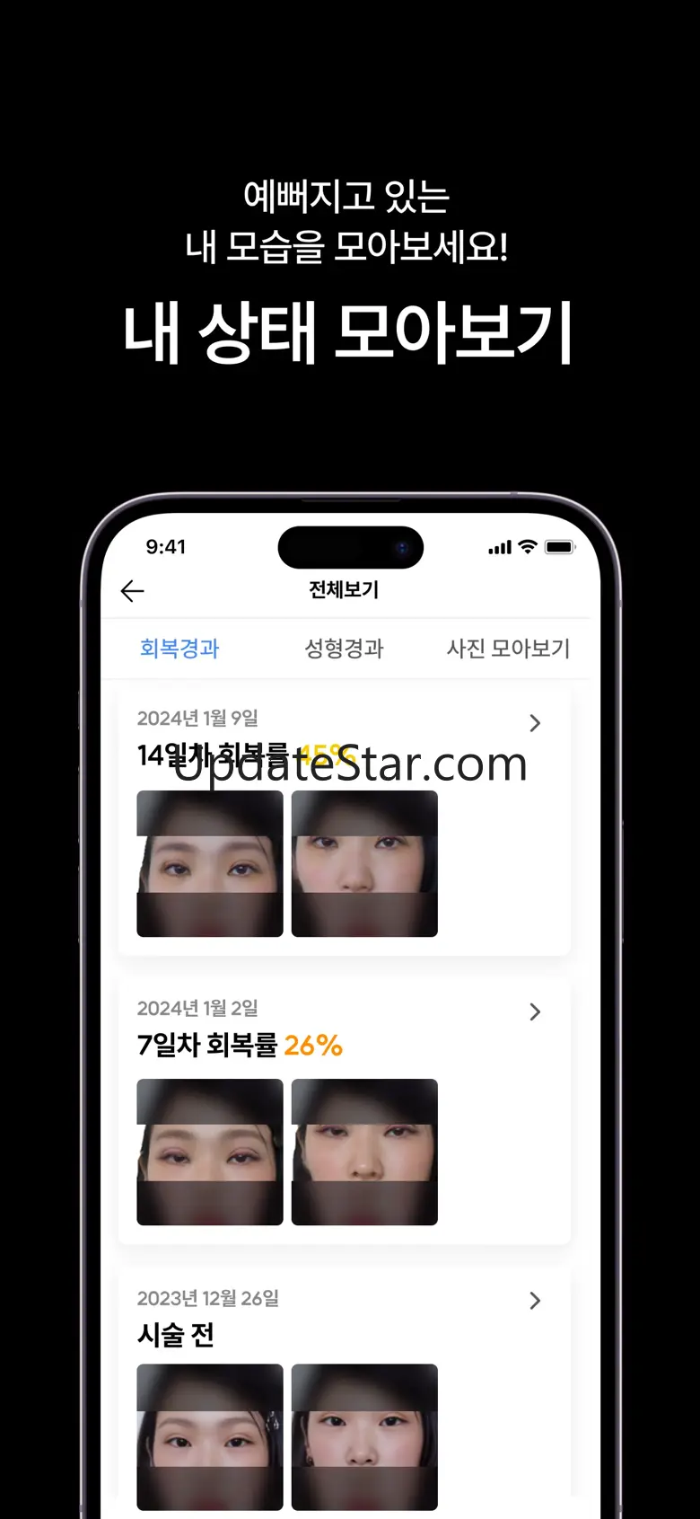 페이스핏 - 성형,견적,상담,분석,시술,얼굴,시뮬레이션 4.10.3
