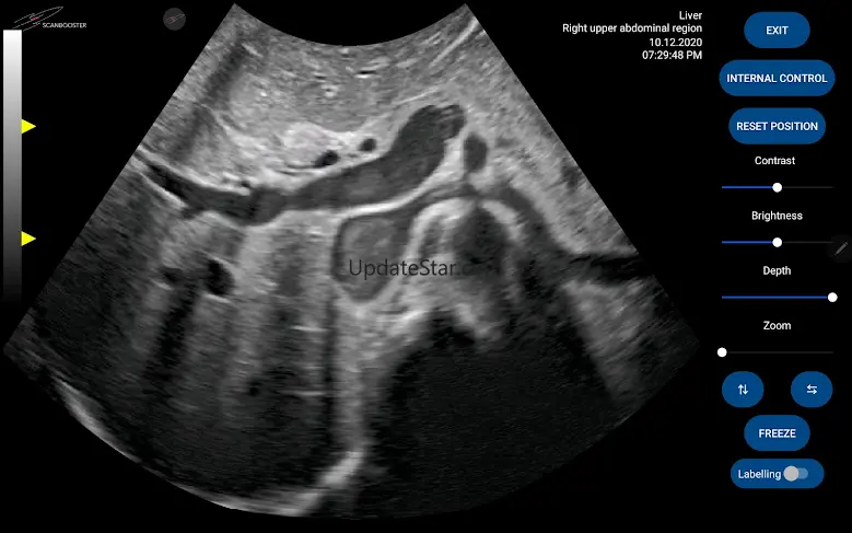 Scanbooster Ultrasound Sim 3.2.3