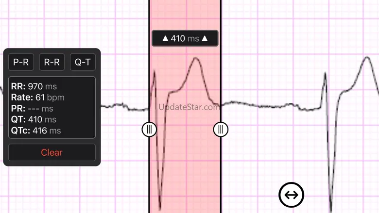 ECG Caliper 4.0