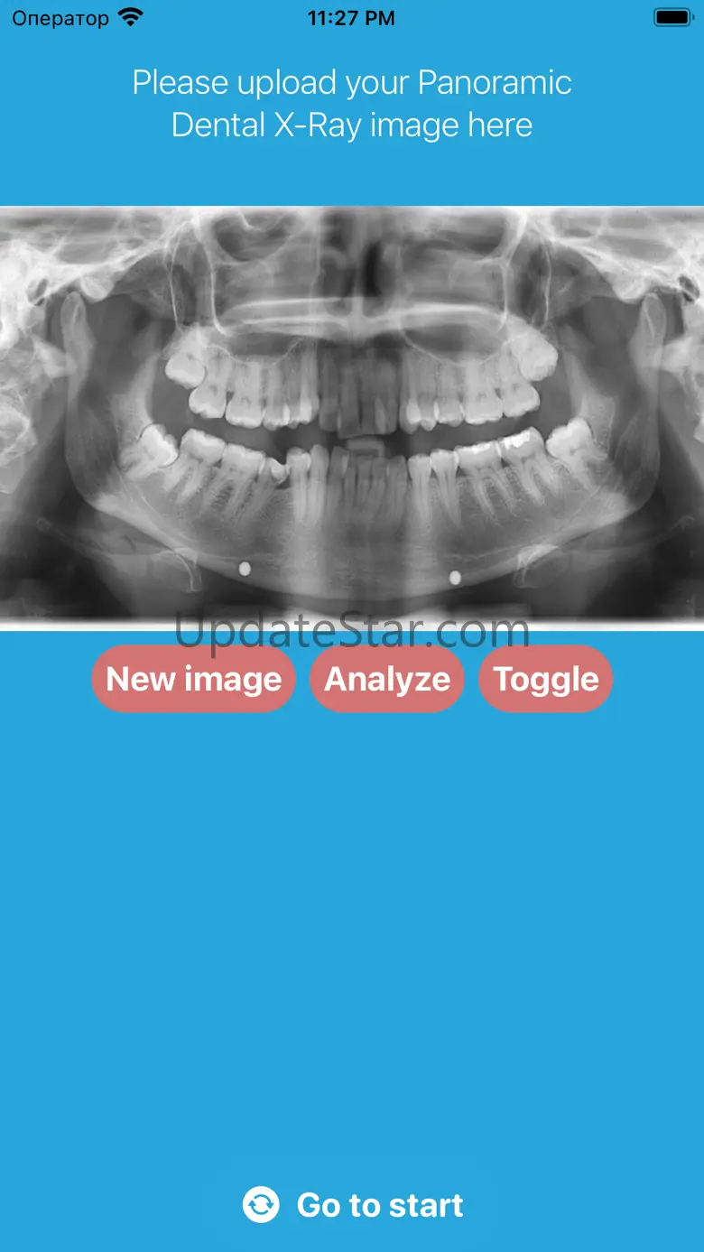 DentalScanner 2.2